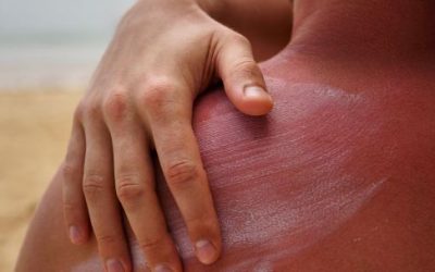 Alerta por radiación UV en Argentina: niveles entre moderados y extremos presentan riesgos para la salud este sábado